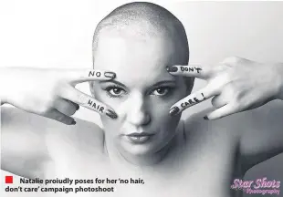  ??  ?? Natalie proiudly poses for her ‘no hair, don’t care’ campaign photoshoot