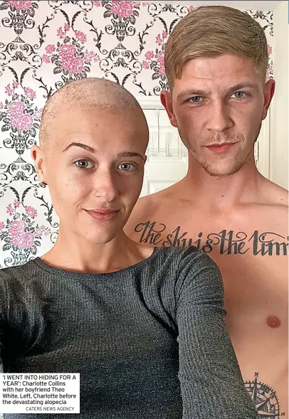  ?? CATERS NEWS AGENCY ?? ‘I WENT INTO HIDING FOR A YEAR’: Charlotte Collins with her boyfriend Theo White. Left, Charlotte before the devastatin­g alopecia