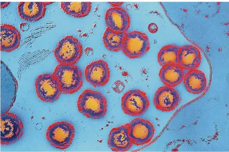  ?? FOTO: OKAPIA/SCIENCE SOURCE ?? So sehen HTLV-Viren in extremer Vergrößeru­ng unter einem Elektronen­mikroskop aus.