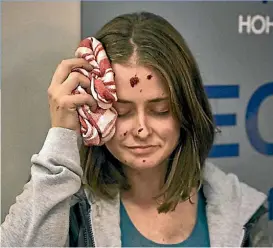  ??  ?? As a part of her role as an extra, Fleur Mealing received shrapnel wounds to her hands and face.