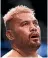  ??  ?? Mark Hunt is suffering from memory loss.