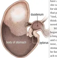  ??  ?? body of stomach duodenum pylorus