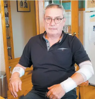  ?? PHOTO COLLABORAT­ION SPÉCIALE, CARL VAILLANCOU­RT ?? Robert Poirier, 66 ans, a été mordu à deux reprises au bras gauche et doit toujours porter des bandages. Il a aussi dû subir une transfusio­n sanguine par le bras droit.