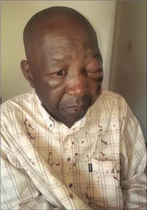  ??  ?? ATTACKED: 57-year-old father-of-two Lazarus Malatji was beaten by a 22-year-old white boy.