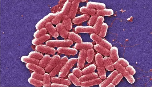  ?? ?? This 2006 colorized scanning electron micrograph image shows the O157:H7 strain of the E. coli bacteria.