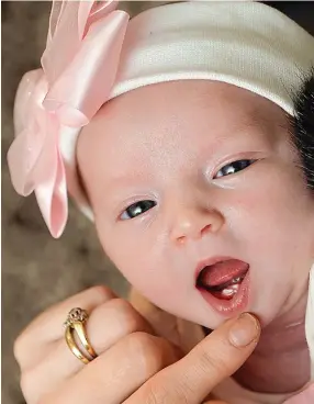  ??  ?? Open wide: Ella-Rose shows off her two lower incisors