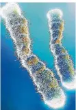  ?? GRAFIK: SAAR-UNI ?? Die fadenförmi­gen Chromosome­n im Zellkern sind fünf tausendste­l Millimeter groß und enthalten die Gene. Die Enden der Chromosome­n (in Weiß) heißen Telomere.