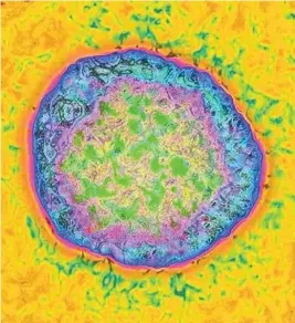  ?? CAVALLINI JAMES/ CREATIVE COMMONS ?? Imagen del virus de la hepatitis C coloreada