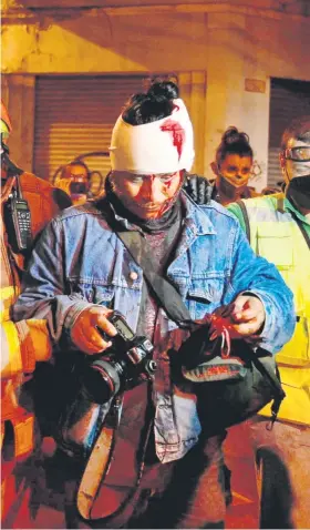  ??  ?? Der Pressefoto­graf Carlos Sebastian wurde bei den Auseinande­rsetzungen verletzt.