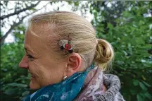  ?? BENNETT CONTRIBUTE­D/PAMELA ?? Amy Stone has a spotted lanternfly on her hair.