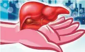  ??  ?? Around 1,700 liver transplant­s are conducted in a year in India