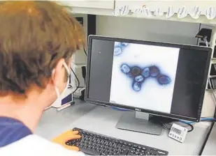  ?? // REUTERS ?? El virus Mpox, al microscopi­o, en una pantalla de un investigad­or