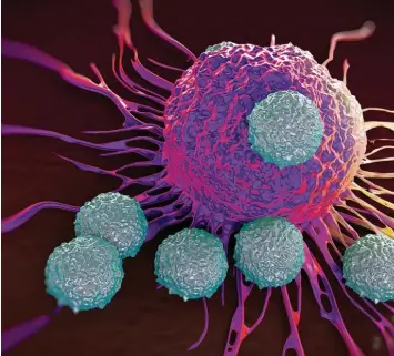  ?? Foto: royaltysto­ckfoto, Fotolia ?? So etwa sieht es aus, wenn CAR T Zellen eine Krebszelle attackiere­n.
