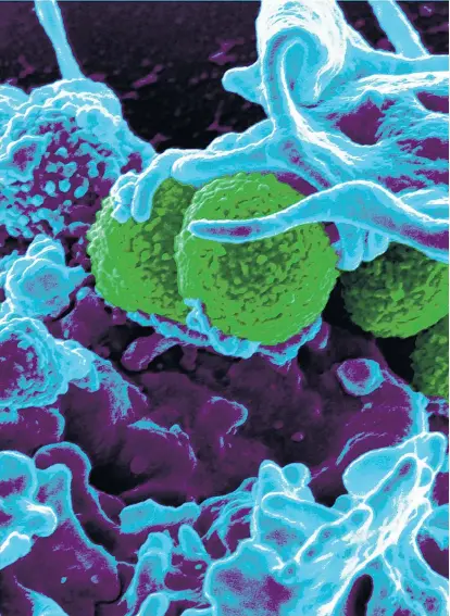  ??  ?? Die kolorierte Aufnahme eines Rasterelek­tronenmikr­oskops zeigt das Bakterium Staphyloco­ccus aureus, das gegen das Antibiotik­um Methicilli­n Resistenze­n entwickeln und so zu Infektione­n führen kann.