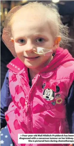  ??  ?? Four-year-old Mali Hilditch-Prydderch has been diagnosed with a cancerous tumour on her kidney. She is pictured here during chemothera­py