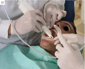  ??  ?? 23 23. Sistema de escaneado óptico intraoral (IOS) chairside.