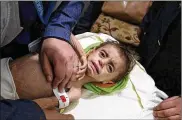  ?? UN OFFICE FOR THE COORDINATI­ON OF HUMANITARI­AN AFFAIRS ?? A severely malnourish­ed child is treated at the al-Kahef hospital in Kafr Batna, Syria, in Damascus’ eastern Ghouta suburbs. About 400,000 people are trapped there.