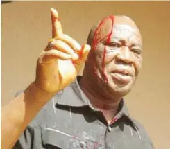  ?? Photo: Sahararepo­rters ?? Mr. Denis after he was attacked within court premises by angry traders.