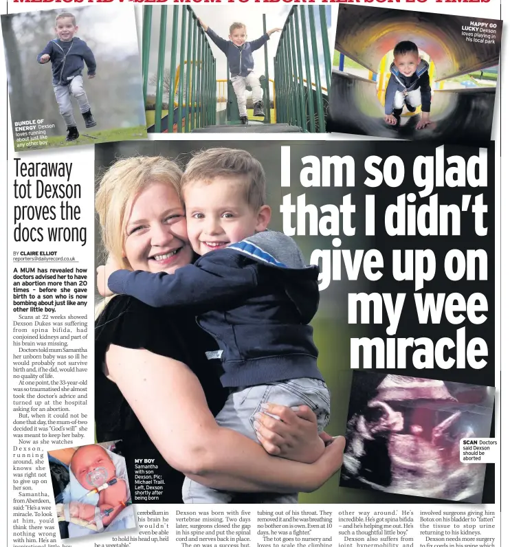  ??  ?? BUNDLE OF ENERGY Dexson loves running about just like any other boy MY BOY Samantha with son Dexson. Pic: Michael Traill. Left, Dexson shortly after being born HAPPY GO LUCKY Dexson loves playing in his local park SCAN Doctors said Dexson should be...