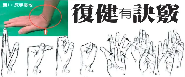 遠端橈骨骨折復健有訣竅 Pressreader