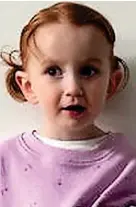  ?? ?? Esme Mariani, aged three, was born with a congenital heart defect