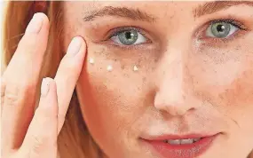  ?? ?? LAS OJERAS, bolsas e inflamació­n son comunes sin importar la edad