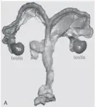  ??  ?? The uterus of an animal suffering from freemartin­ism