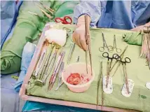  ?? Jon Shapley/Staff photograph­er ?? The malignant tumor removed from Suzette Stover’s heart sits in a bowl during her surgery in February.