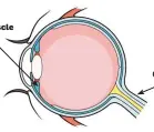  ??  ?? Optic nerve Ciliary Muscle