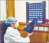  ?? ANI ?? A doctor at Sir Ganga Ram hospital examines a patient’s CT scan for signs of mucormycos­is.