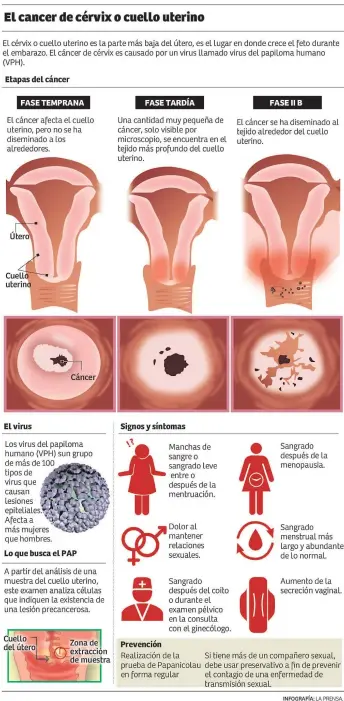 papilloma cancer de matriz