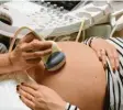  ?? Foto: dpa ?? Ultraschal­l bei Schwangere­n ist nur mit medizinisc­hem Grund möglich.