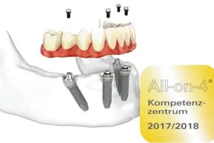  ?? Foto: Nobel Biocare ?? Die Praxiszahn­klinik Günzburg ist seit dem 1. August 2016 zertifizie­rtes All-on-4® Kompetenzz­entrum.