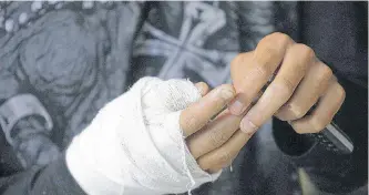  ?? JHON JAIRO BONILLA / ARCHIVO ADN ?? Las manos son las más afectadas en los accidentes. Hay casos de amputacion­es y contusione­s.