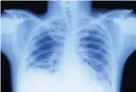  ??  ?? > The X-ray was first demonstrat­ed on this day in 1896