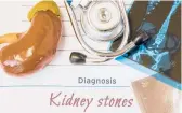  ?? DREAMSTIME ?? Kidney stones are small, hard deposits made of minerals and acid salts that form inside the kidneys.