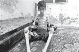  ?? Local Revolution­ary Council in Madaya ?? A BOY in Madaya, Syria. Doctors Without Borders reported that at least 23 people have starved to death in the town since the beginning of December.