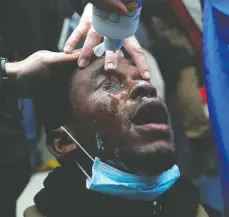  ?? SHANNON STAPLETON / REUTERS ?? A Capitol rioter is treated after getting pepper-sprayed during
clashes with police on Wednesday in Washington, D.C.