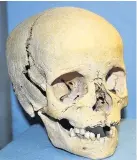 ??  ?? >
The child’s skull was once owned by a collector of macabre artefacts