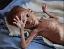  ??  ?? Millions face starvation in Yemen.