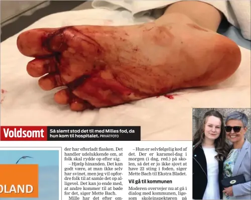  ?? PRIVATFOTO PRIVATFOTO ?? Voldsomt Så slemt stod det til med Milles fod, da hun kom til hospitalet. 14-årige Mille sammen med sin mor, Mette Bach, i et noget lykkeliger­e øjeblik.