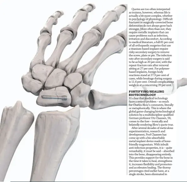  ??  ?? Below: A pin in place in a fractured lunate wrist bone.