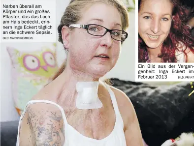  ?? BILD: Martin Remmers BILD: Privat ?? Narben überall am Körper und ein großes Pflaster, das das Loch am Hals bedeckt, erinnern Inga Eckert täglich an die schwere Sepsis.
Ein Bild aus der Vergangenh­eit: Inga Eckert im Februar 2013