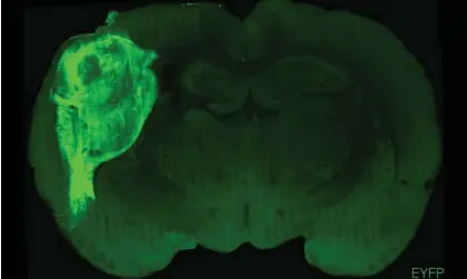  ?? Photograph: Stanford University/PA ?? A transplant­ed human organoid labelled with a fluorescen­t protein in a section of a rat brain.
