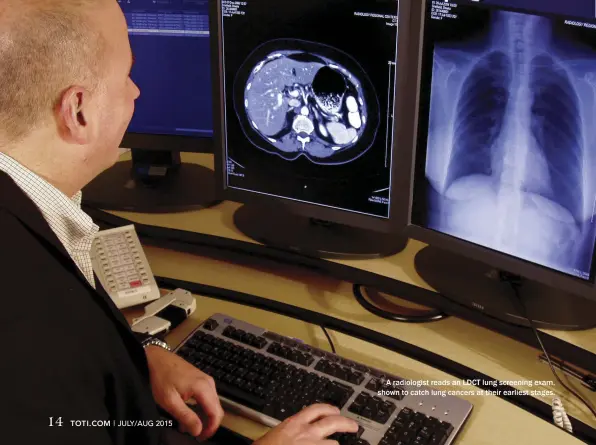  ??  ?? A radiologis­t reads an LDCT lung screening exam, shown to catch lung cancers at their earliest stages.