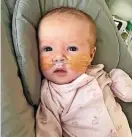  ?? ?? ■ Baby Rosie Robson from Chester-lestreet is now recovering after spending a fortnight in intensive care