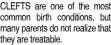  ?? ?? CLEFTS are one of the most common birth conditions, but many parents do not realize that they are treatable.