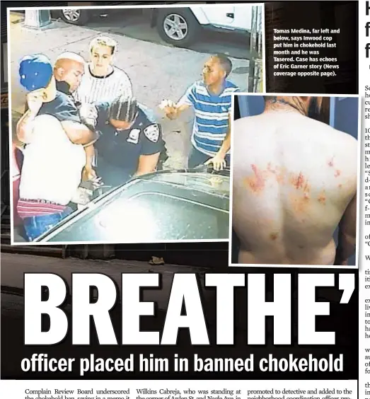  ??  ?? Tomas Medina, far left and below, says Inwood cop put him in chokehold last month and he was Tasered. Case has echoes of Eric Garner story (News coverage opposite page).