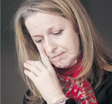  ?? JOHN WOODS / THE CANADIAN PRESS FILES ?? Winnipeg lawyer Maria Mitousis, shown here following a 2015 letter-bombing that resulted in the loss of her right hand and other severe injuries, told a sentencing hearing Wednesday she is ready to move on with her life.