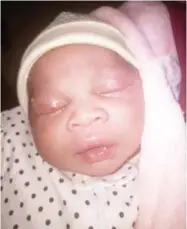  ??  ?? This is the newborn baby injured by the nurse